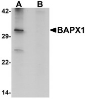 Anti-NKX3-2 / BAPX1 Antibody (Internal) IHC-plus LS-B7039