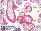 Anti-CGB / hCG Beta Antibody (aa101-150) IHC-plus LS-B7043