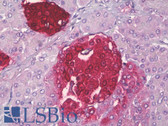 Anti-SST / Somatostatin Antibody (aa10-59) IHC-plus LS-B7046
