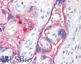 Anti-15-PGDH / HPGD Antibody IHC-plus LS-B115
