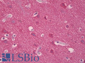Anti-Synuclein Antibody (aa15-64) IHC-plus LS-B7048
