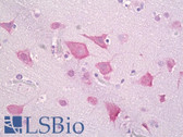 Anti-CSNK1E / CK1 Epsilon Antibody (aa276-325) IHC-plus LS-B7056
