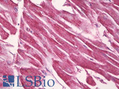 Anti-LAMB1 / Laminin Beta 1 Antibody (aa1721-1770) IHC-plus LS-B7061