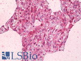 Anti-ABCB7 Antibody (aa691-740) IHC-plus LS-B7063