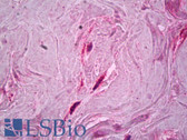 Anti-FN1 / Fibronectin Antibody (clone 23C9) IHC-plus LS-B7080