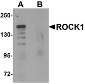 Anti-Rho Kinase / ROCK1 Antibody (N-Terminus) IHC-plus LS-B7100