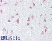 Anti-SIK1 / MSK Antibody (Internal) IHC-plus LS-B7102
