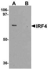 Anti-IRF4 Antibody (C-Terminus) IHC-plus LS-B7104