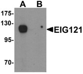 Anti-KIAA1324 / maba1 Antibody (C-Terminus) IHC-plus LS-B7110