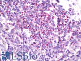 Anti-CCR7 Antibody (Extracellular Domain, clone E75) IHC-plus LS-B7115