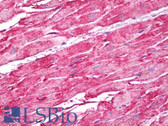 Anti-CDH13 / Cadherin 13 Antibody (N-Terminus) IHC-plus LS-B7119