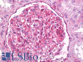 Anti-ITGB1 / Integrin Beta 1 / CD29 Antibody (Extracellular Domain, clone LM534) IHC-plus LS-B7121