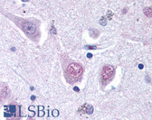 Anti-RGS2 Antibody (aa1-50) IHC-plus LS-B122