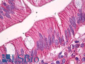 Anti-SPTAN1 / Alpha Fodrin Antibody (Internal, clone EPR3016) IHC-plus LS-B7126