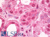 Anti-TCF7L2 / TCG4 Antibody (N-Terminus) IHC-plus LS-B7129