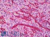 Anti-Vimentin Antibody (clone 35E2) IHC-plus LS-B7135