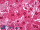 Anti-GSR / Glutathione Reductase Antibody IHC-plus LS-B7144