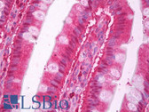 Anti-CAT / Catalase Antibody IHC-plus LS-B7145