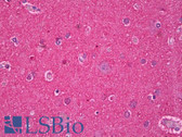 Anti-MAPT / Tau Antibody IHC-plus LS-B7152