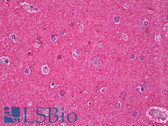 Anti-MAPT / Tau Antibody IHC-plus LS-B7152