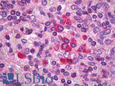 Anti-BCL2 / Bcl-2 Antibody IHC-plus LS-B7155