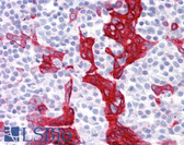 Anti-Cytokeratin 10+13 Antibody (clone DE-K13) IHC-plus LS-B7168
