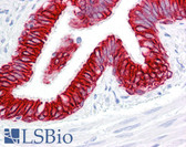 Anti-KRT19 / CK19 / Cytokeratin 19 Antibody (clone RCK108) IHC-plus LS-B7172
