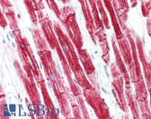 Anti-DES / Desmin Antibody (clone D9) IHC-plus LS-B7175
