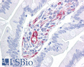 Anti-Nestin Antibody (clone 10C2) IHC-plus LS-B7181