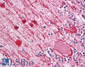 Anti-NF-L / NEFL Antibody (clone 2F11) IHC-plus LS-B7182