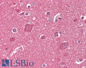 Anti-RTN1 / Reticulon 1 Antibody (clone RNL-2) IHC-plus LS-B7188