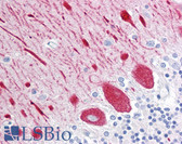 Anti-RTN1 / Reticulon 1 Antibody (clone RNL-3) IHC-plus LS-B7189