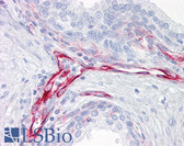 Anti-Vimentin Antibody (clone V9) IHC-plus LS-B7192