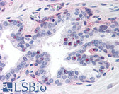 Anti-PPARG / PPAR Gamma Antibody (N-Terminus) IHC-plus LS-B130