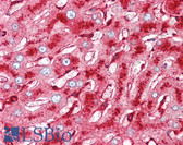 Anti-Melanoma-Associated Antigen Antibody (clone NKI-C3) IHC-plus LS-B7204