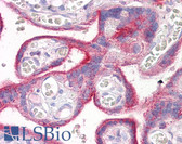 Anti-ERBB2 / HER2 Antibody (clone 3B5) IHC-plus LS-B7205