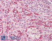 Anti-NAMPT / Visfatin Antibody (aa30-80) IHC-plus LS-B7208