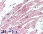 Anti-AXL Antibody (aa450-500) IHC-plus LS-B7213