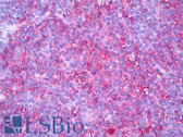 Anti-HLA-DR Antibody (clone YE2/36 HLK) IHC-plus LS-B7229