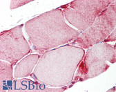 Anti-RORA / ROR Alpha Antibody (aa80-120) IHC-plus LS-B7230