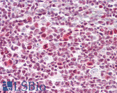 Anti-IKZF3 / AIOLOS Antibody (aa350-400) IHC-plus LS-B7231