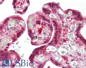 Anti-SNX2 Antibody (aa350-400) IHC-plus LS-B7232