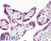 Anti-JMJD6 / PSR Antibody (aa127-144) IHC-plus LS-B7234
