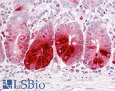 Anti-REG3A Antibody (aa1-50) IHC-plus LS-B7238