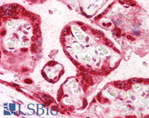 Anti-HMGB3 Antibody (aa150-200) IHC-plus LS-B7239