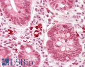 Anti-DNMT3A Antibody (aa170-220) IHC-plus LS-B7240
