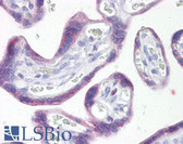 Anti-SNAI1 / SNAIL-1 Antibody (aa80-130) IHC-plus LS-B7247