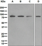 Anti-EWSR1 / EWS Antibody (Internal, clone EPR4647) IHC-plus LS-B7255