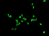 Anti-AR / Androgen Receptor Antibody (N-Terminus, clone ER179(2)) IHC-plus LS-B7258