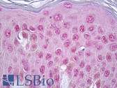 Anti-Vitamin D Receptor / VDR Antibody (aa181-230) IHC-plus LS-B7259